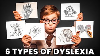 6 Types of Dyslexia 🤔 [upl. by Arratal]