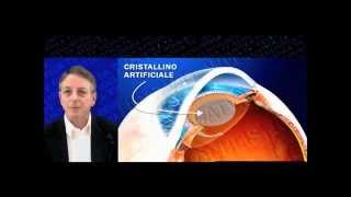 Cataratta secondaria capsulotomia laser YAG [upl. by Isabel]