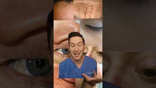 Whats that on your face dermatologist explains fibrous papules fibrouspapule derm nosebump [upl. by Nahc]