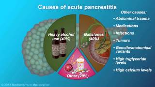 Acute Pancreatitis [upl. by Ydroj408]