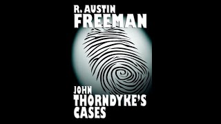 John Thorndykes Cases by R Austin Freeman  Audiobook [upl. by Akinna]