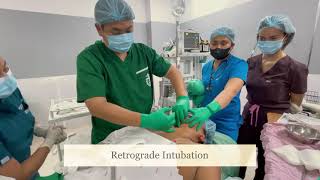 Retrograde Intubation [upl. by Galen611]