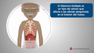 ¿Qué es el Mieloma Múltiple [upl. by Douglass]