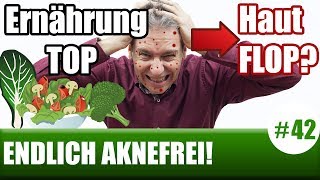 Schlechtere Haut durch bessere Ernährung ENDLICH AKNEFREI 42 [upl. by Chery365]