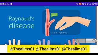 Raynauds Disease MSN topic ryanuadsdiseasetheaiims01 [upl. by Nenad]