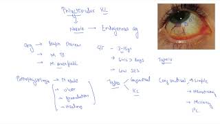 Phlyctenular conjunctivitis [upl. by Serles622]