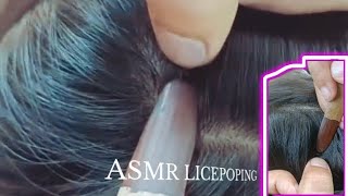 hundred remove licepoping at from head hairliceliceheadremvelicelicepopinglicepepbiglice [upl. by Hime]