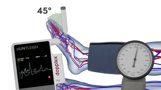 How to Measure the Systolic Pressure of the Dorsalis Pedis when Performing an ABPI [upl. by Kciregor]