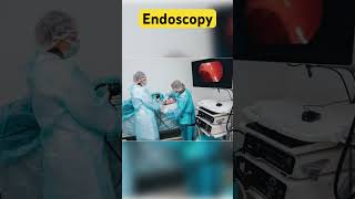 Endoscopy test  Endoscopy shorts endoscope endoscopy ytshorts ytshort health hospital [upl. by Nel144]