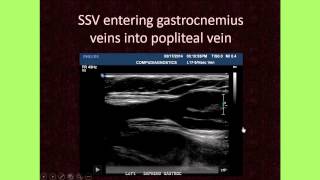 The Importance of Venous Anatomy for the Reflux Ultrasound Examination [upl. by Junna621]