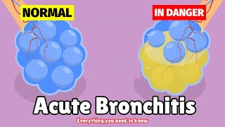 What is Acute Bronchitis  Causes Symptoms Diagnosis amp Treatment [upl. by Annerahs792]