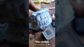 Wax mokab🦷 5Unitlowerdentaldentistmumbaiindianslaboratoryyoutube sortvideo [upl. by Aylatan]