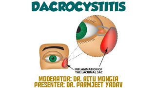 Dacryocystitis  Symptoms  Causes  Treatment [upl. by Teriann507]