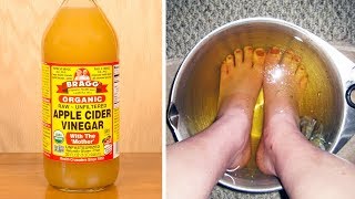 Soak Your Feet In Apple Cider Vinegar For This Incredible Benefits [upl. by Elspet]