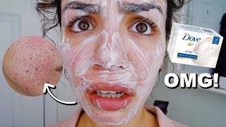 I USED DOVE SOAP ON MY FACE [upl. by Templer]