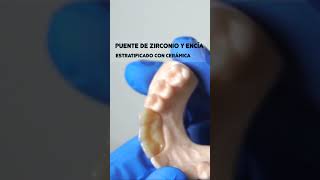 Puente de Zirconio estratificado con cerámica y cerámica de encíaimpresión dental 3d [upl. by Cart]