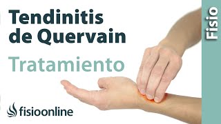 Tendinitis de De Quervain  Tratamiento con ejercicios automasajes y estiramientos [upl. by Htrap]