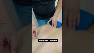 Muscle pain Treatment shorts shortsfeed [upl. by Torrence61]