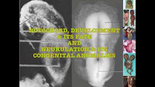 Notochord amp Neurulation Details along with genes [upl. by Rolo36]