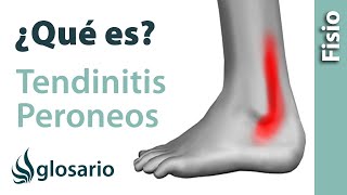 TENDINITIS DE LOS MÚSCULOS PERONEOS  ¿Qué es [upl. by Drofdarb651]