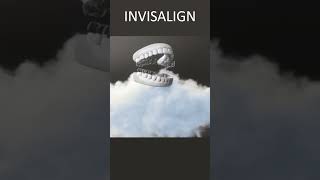 Invisalign Underbite  Time Lapse  London UK [upl. by Dorrehs]