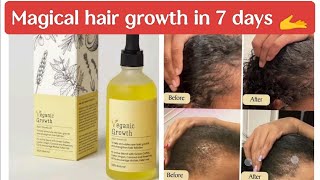 veganic natural hair growth oil review tamil hairfalltreatment [upl. by Morganstein126]