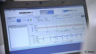 Longterm home monitoring of cardiac patients with imecs ECG patch [upl. by Synn]