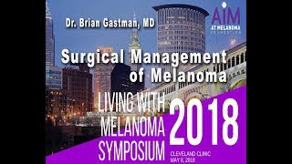 Surgical Management of Melanoma [upl. by Ococ]