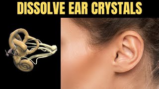 How to Dissolve Crystals in the Inner Ear and Get Rid of Vertigo [upl. by Territus]