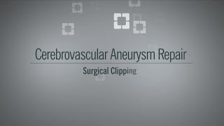 Aneurysm Clipping Surgery [upl. by Nitfa]