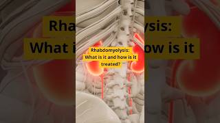 MRCP Shorts Rhabdomyolysis [upl. by Yngad]