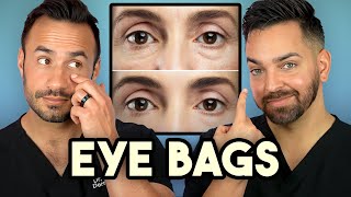 How Treat Under Eye Bags Like A Dermatologist [upl. by Tanah]