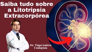 Saiba tudo sobre a Litotripsia Extracorpórea [upl. by Adrienne]