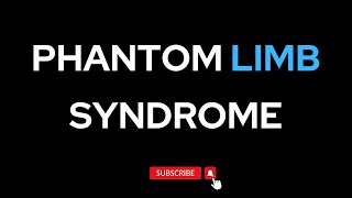 Phantom Limb Syndrome [upl. by Madeline102]