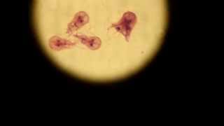 Giardia lamblia Trophozoite [upl. by Yelkrab14]