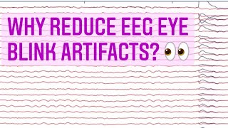 why reduce EEG eye blink artifacts [upl. by Haney936]