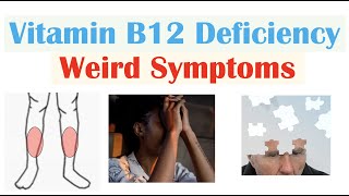 Vitamin B12 Deficiency Weird Symptoms amp Why They Occur [upl. by Klein]