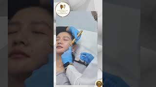 Jaw Botox Procedure [upl. by Rihana357]