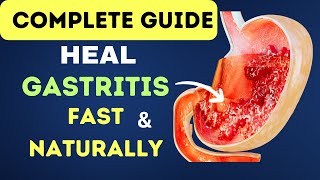 A Complete Guide to Heal Gastritis Fast and Naturally  Gastritis Relief [upl. by Akimot517]