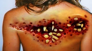 Ten Bizarre Trypophobia Examples by CystBurstingcom [upl. by Mak]