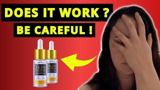 SKIN BIOTIX MD SKIN TAG REMOVER REVIEWS ❌NEW ALERT❌ Skin Biotix Skin Tag Remover Review [upl. by Zalea]