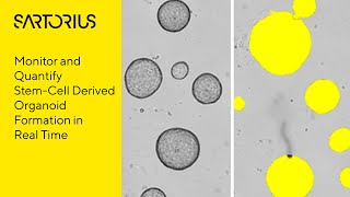 Incucyte Webinar Preview Studying 3D Organoids with LiveCell Analysis [upl. by Bissell]