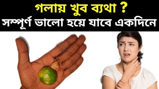 গলায় ব্যথা হলে কি করা উচিতgola betha hole ki korboHome Remedies for Sore Throatpts [upl. by Karola]