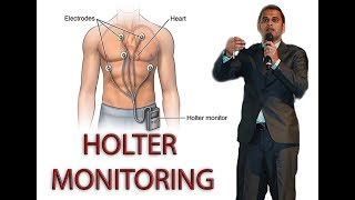 HOLTER MONITORING [upl. by Gottlieb389]