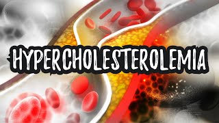 Hypercholesterolemia High Cholesterol  CRASH Medical Review Series [upl. by Robinia]