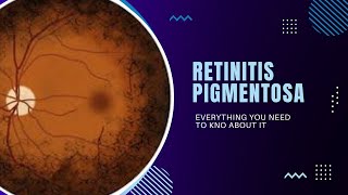 Retinitis Pigmentosa  Genetics Pathophysiology Signs amp Symptoms Diagnosis Treatment [upl. by Munt]