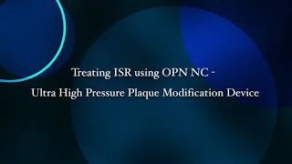 OPN NC  Ultra High Pressure plaque modification Device [upl. by Buehler224]