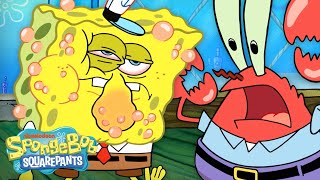 Is SpongeBob Allergic To Krabby Patties 😱 quotAllergy Attackquot Full Scene  SpongeBob [upl. by Hawkins178]