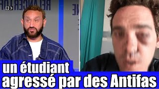 Un étudiant Agressé par des Antifas dans son université 😡 le Tshirt anti J  UIF 🤦‍ TPMP réaction [upl. by Avonasac]