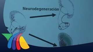 Descubren posible cura para el mal de Parkinson [upl. by Essie]